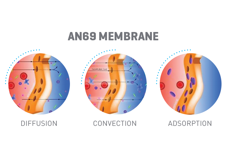 AN69 membrane types have diffusive and convective capabilities. In addition, they also have adsorptive capabilities.