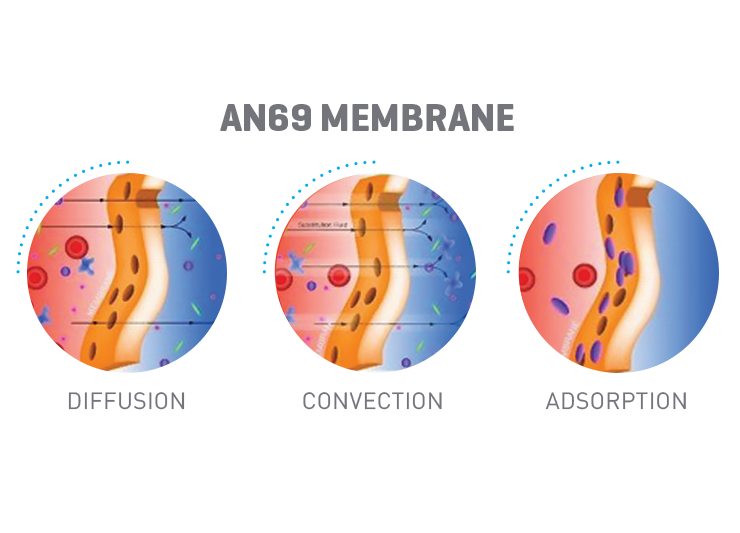 AN69 membrane types have diffusive and convective capabilities. In addition, they also have adsorptive capabilities.